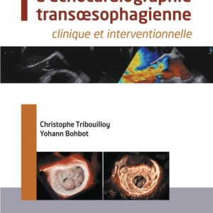 Guide pratique d’échocardiographie transœsophagienne: clinique et interventionnelle (True PDF from Publisher)