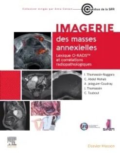 Imagerie des masses annexielles: Lexique O-RADS et corrélations radiopathologiques (True PDF from Publisher)