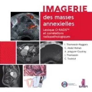 Imagerie des masses annexielles: Lexique O-RADS et corrélations radiopathologiques (True PDF from Publisher)