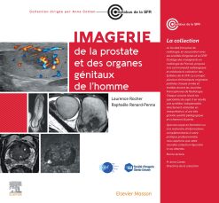 Imagerie de la prostate et des organes génitaux de l’homme (Original PDF from Publisher)