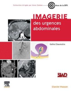 Imagerie des urgences abdominales (Original PDF from Publisher)