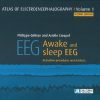 Atlas of Electroencephalography. Awake and sleep EEG. Activation procedures and artifacts, Volume 1, 2nd Edition (Original PDF from Publisher)