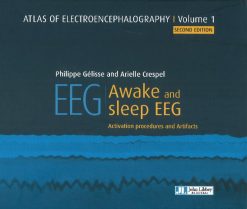 Atlas of Electroencephalography. Awake and sleep EEG. Activation procedures and artifacts, Volume 1, 2nd Edition (Original PDF from Publisher)