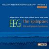 Atlas of electroencephalography: The Epilepsies. EEG and epileptic syndromes Vol 2 (ePub+Converted PDF)