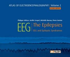 Atlas of electroencephalography: The Epilepsies. EEG and epileptic syndromes Vol 2 (ePub+Converted PDF)