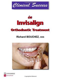 Clinical Success in Invisalign Orthodontic Treatment (EPUB)