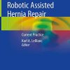 Robotic Assisted Hernia Repair: Current Practice (Original PDF from Publisher)