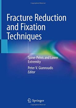 Fracture Reduction and Fixation Techniques: Spine-Pelvis and Lower Extremity (Original PDF from Publisher)