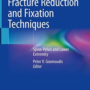 Fracture Reduction and Fixation Techniques: Spine-Pelvis and Lower Extremity (Original PDF from Publisher)