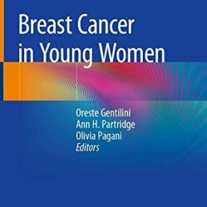 Breast Cancer in Young Women (Original PDF from Publisher)