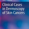 Clinical Cases in Dermoscopy of Skin Cancers (Clinical Cases in Dermatology) (Original PDF from Publisher)