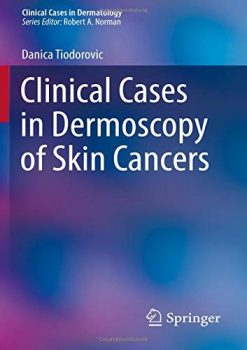 Clinical Cases in Dermoscopy of Skin Cancers (Clinical Cases in Dermatology) (Original PDF from Publisher)