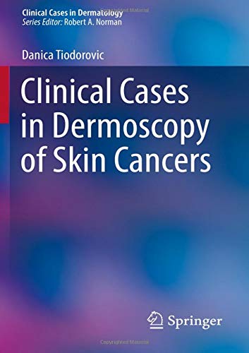 Clinical Cases in Dermoscopy of Skin Cancers (Clinical Cases in Dermatology) (Original PDF from Publisher)