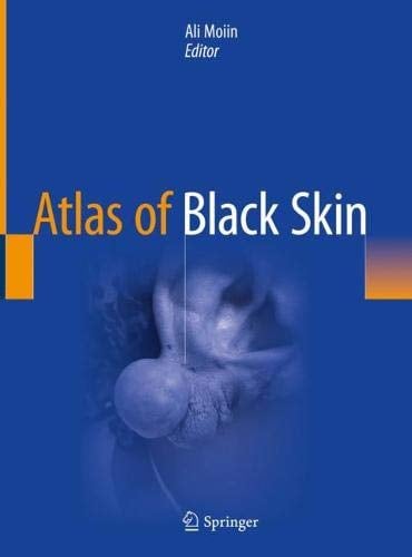 Atlas of Black Skin (Original PDF from Publisher)