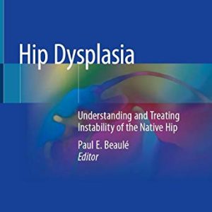 Hip Dysplasia: Understanding and Treating Instability of the Native Hip (Original PDF from Publisher)