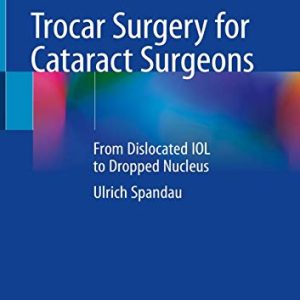 Trocar Surgery for Cataract Surgeons: From Dislocated IOL to Dropped Nucleus (Original PDF from Publisher)