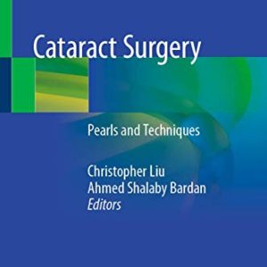 Cataract Surgery: Pearls and Techniques (Original PDF from Publisher)