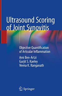 Ultrasound Scoring of Joint Synovitis: Objective Quantification of Articular Inflammation (Original PDF from Publisher)