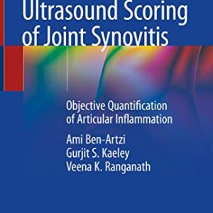 Ultrasound Scoring of Joint Synovitis: Objective Quantification of Articular Inflammation (Original PDF from Publisher)
