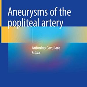 Aneurysms of the Popliteal Artery (Original PDF from Publisher)