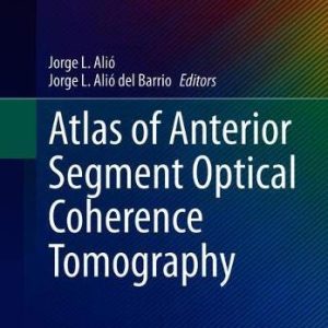 Atlas of Anterior Segment Optical Coherence Tomography (Essentials in Ophthalmology) (Original PDF from Publisher)