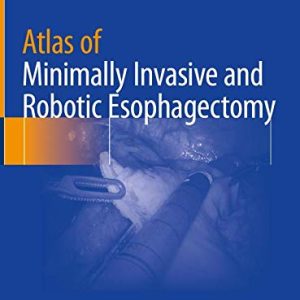 Atlas of Minimally Invasive and Robotic Esophagectomy (Original PDF from Publisher)