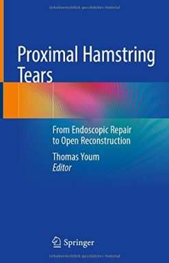 Proximal Hamstring Tears: From Endoscopic Repair to Open Reconstruction (Original PDF from Publisher)