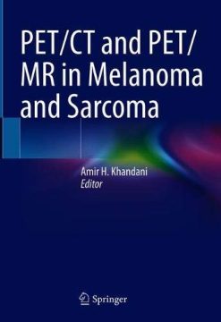 PET/CT and PET/MR in Melanoma and Sarcoma (Original PDF from Publisher)