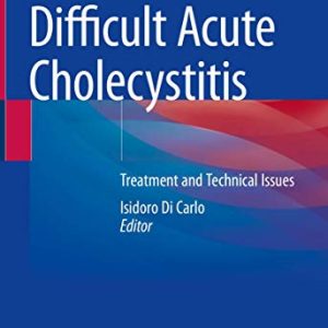 Difficult Acute Cholecystitis: Treatment and Technical Issues (Original PDF from Publisher)