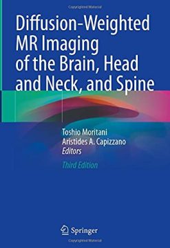 Diffusion-Weighted MR Imaging of the Brain, Head and Neck, and Spine (Original PDF from Publisher)