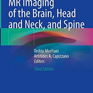 Diffusion-Weighted MR Imaging of the Brain, Head and Neck, and Spine (Original PDF from Publisher)