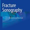 Fracture Sonography: A Comprehensive Clinical Guide (Original PDF from Publisher)