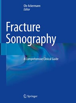 Fracture Sonography: A Comprehensive Clinical Guide (Original PDF from Publisher)