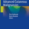 New Therapies in Advanced Cutaneous Malignancies (Original PDF from Publisher)