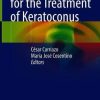 New Frontiers for the Treatment of Keratoconus (Original PDF from Publisher)