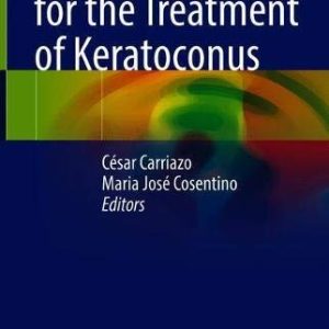New Frontiers for the Treatment of Keratoconus (Original PDF from Publisher)