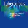 Essential Tuberculosis (Original PDF from Publisher)
