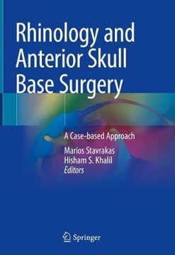 Rhinology and Anterior Skull Base Surgery: A Case-based Approach (Original PDF from Publisher)
