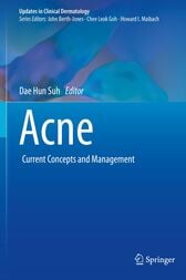 Acne : Current Concepts and Management (Original PDF from Publisher)
