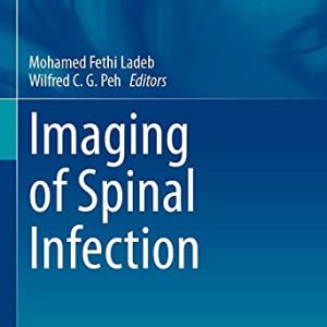 Imaging of Spinal Infection (Medical Radiology) (Original PDF from Publisher)