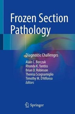 Frozen Section Pathology: Diagnostic Challenges (Original PDF from Publisher)