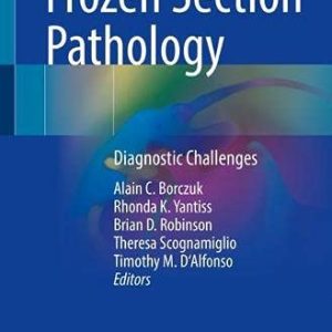 Frozen Section Pathology: Diagnostic Challenges (Original PDF from Publisher)