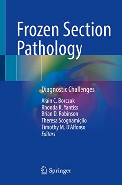 Frozen Section Pathology: Diagnostic Challenges (Original PDF from Publisher)