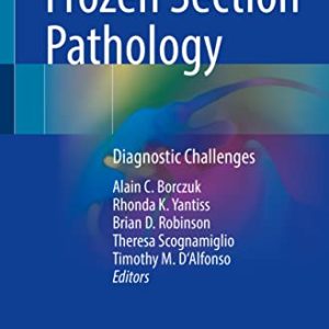 Frozen Section Pathology: Diagnostic Challenges (Original PDF from Publisher)