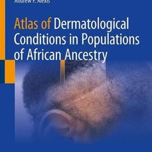 Atlas of Dermatological Conditions in Populations of African Ancestry (Original PDF from Publisher)