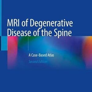 MRI of Degenerative Disease of the Spine: A Case-Based Atlas, 2nd Edition (Original PDF from Publisher)