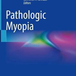 Pathologic Myopia, 2nd Edition (Original PDF from Publisher)
