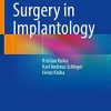 Guided Surgery in Implantology (Original PDF from Publisher)