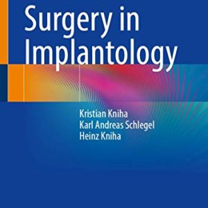 Guided Surgery in Implantology (Original PDF from Publisher)