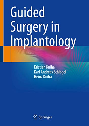 Guided Surgery in Implantology (Original PDF from Publisher)